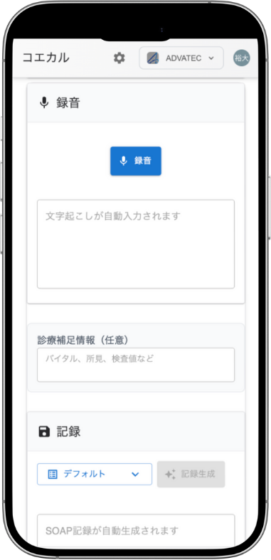 コエカル iPhone画面